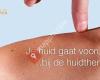 Huidtherapie Eelde-Paterswolde