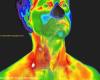 Medical Thermography