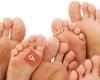 Pedicure Zutphen Sowfeet