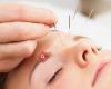 Praktijk voor acupunctuur en fysiotherapie B. Speekenbrink