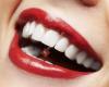 Restyle your smile & centrum voor mond- en gezichtsverzorging de Lind